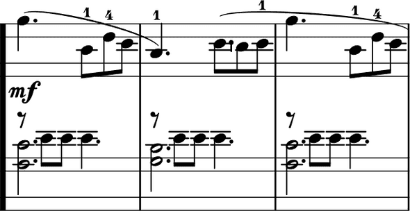 La Pastorale measure 11 with incorrect stem directions La Pastorale measure 11 with incorrect stem directions